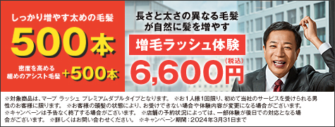 1000本キャンペーンバナー