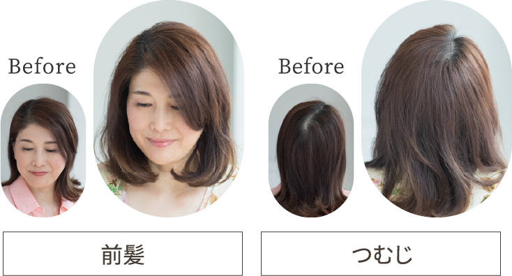 前髪つむじ
