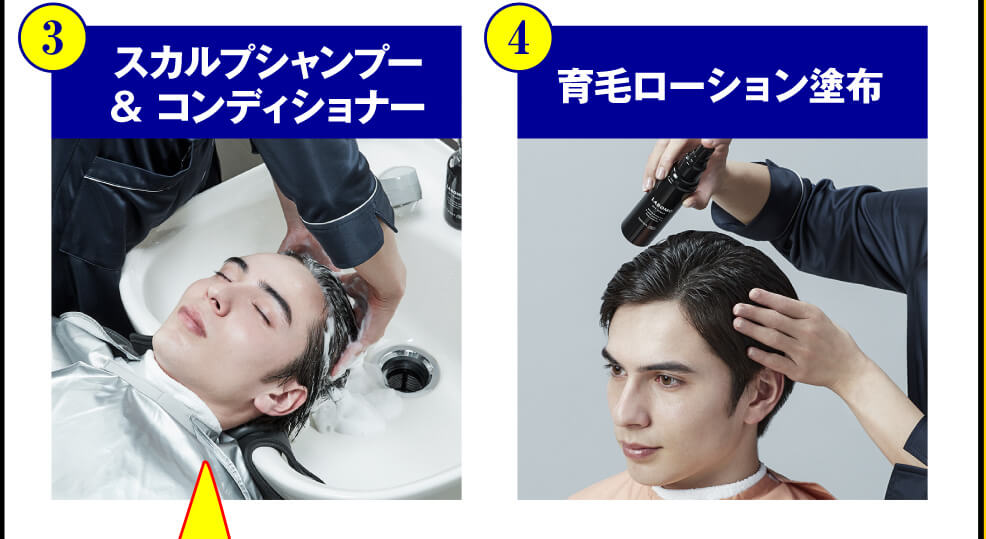 ③スカルプシャンプー＆コンディショナー　④育毛ローション塗布