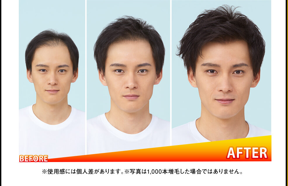 ※使用感には個人差があります　※写真は1000本増毛した場合ではありません。