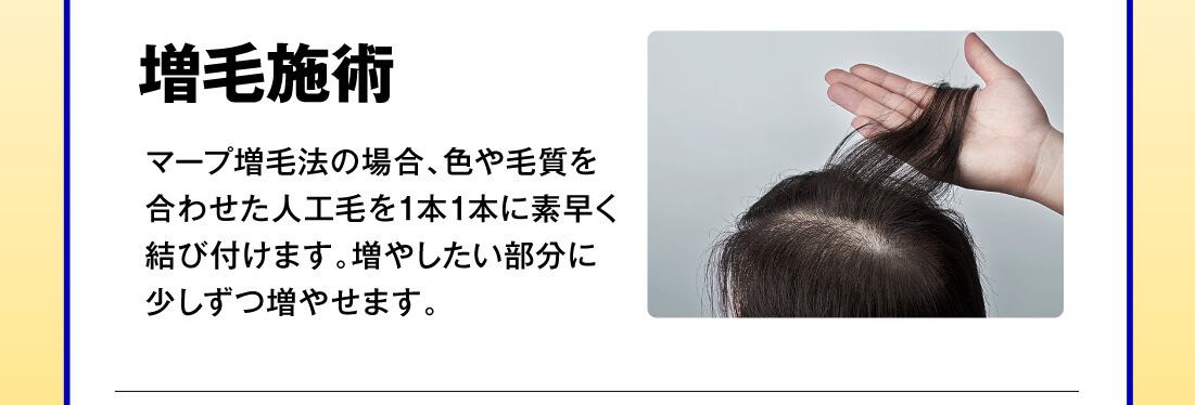 増毛施術