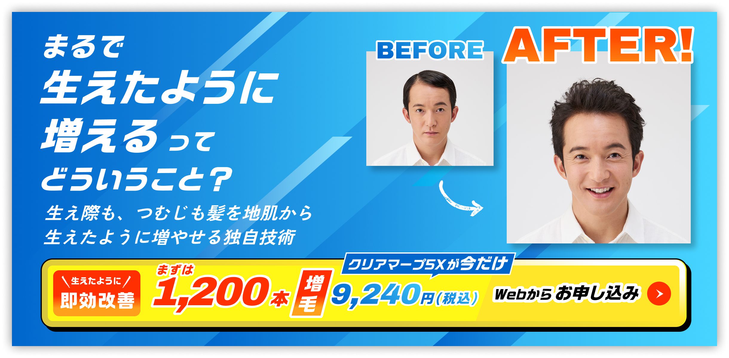 まるで生えたように増えるってどういうこと？生え際も、つむじも髪を地肌から生えたように増やせる独自技術　まずは1,200本増毛 生えたように即効改善 今だけ！9,240円(税込)お申し込みボタン