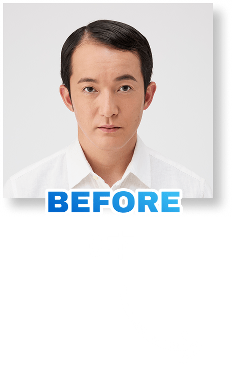 BEFORE0本