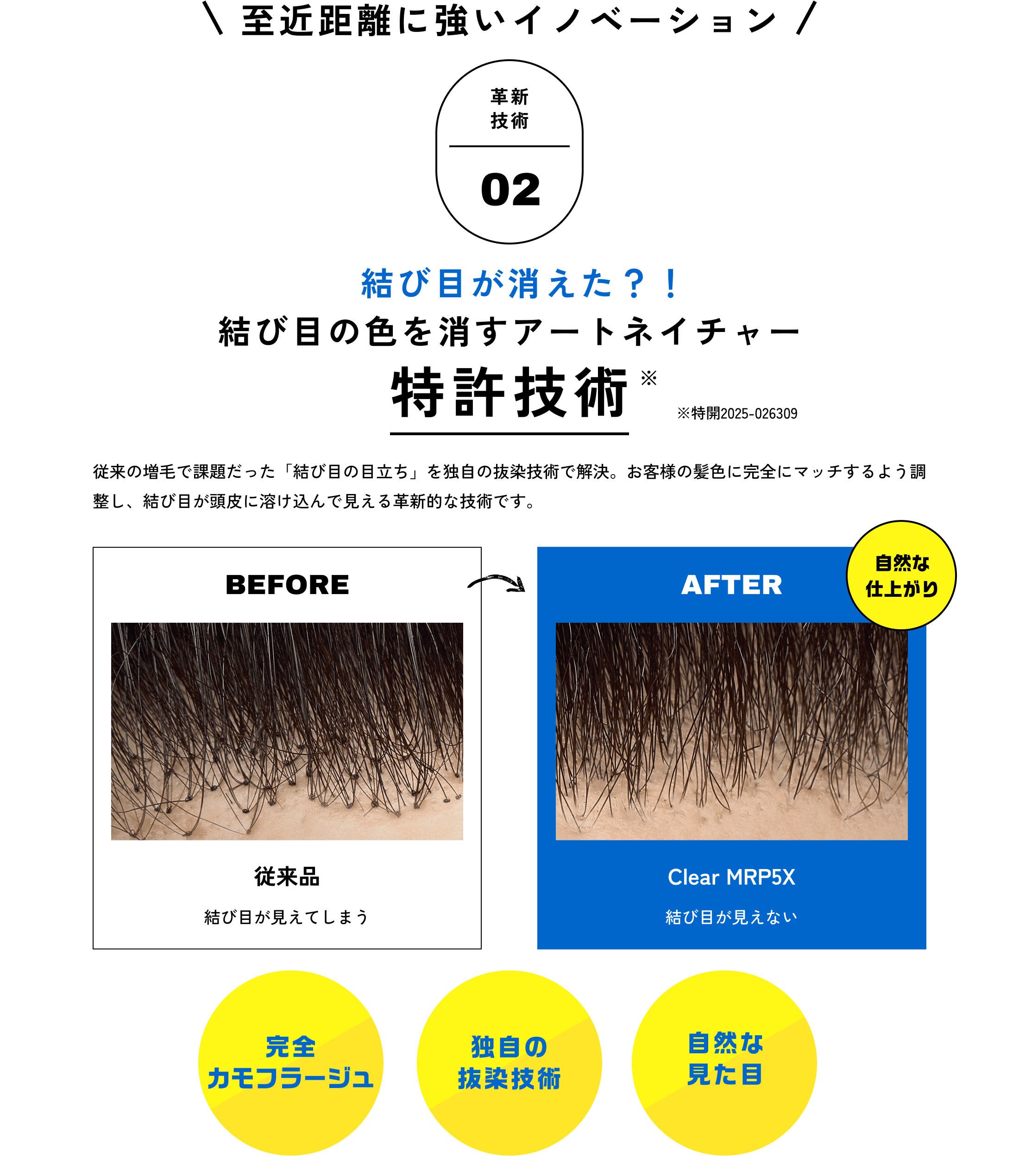 至近距離に強いイノベーション　革新技術02　結び目の色を消す　結び目が消えた？！　特許技術　※特開2025-026309　従来の増毛で課題だった「結び目の目立ち」を独自の抜染技術で解決。お客様の髪色に完全にマッチするよう調整し、結び目が頭皮に溶け込んで見える革新的な技術です。BEFORE　AFTER　自然な　仕上がり　従来品　Clear MRP5X　結び目が見えてしまう　結び目が見えない　完全カモフラージュ　独自の抜染技術　自然な見た目
