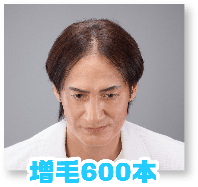 増毛600本