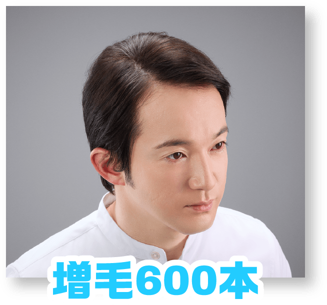 増毛600本