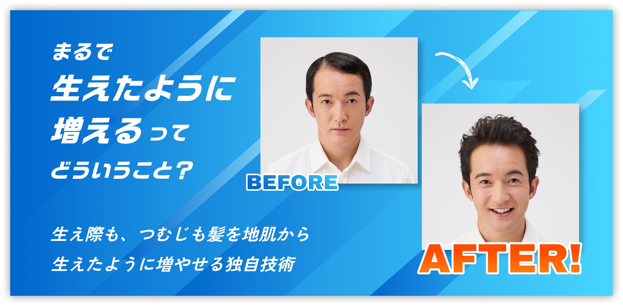 まるで生えたように増えるってどういうこと？生え際も、つむじも髪を地肌から生えたように増やせる独自技術