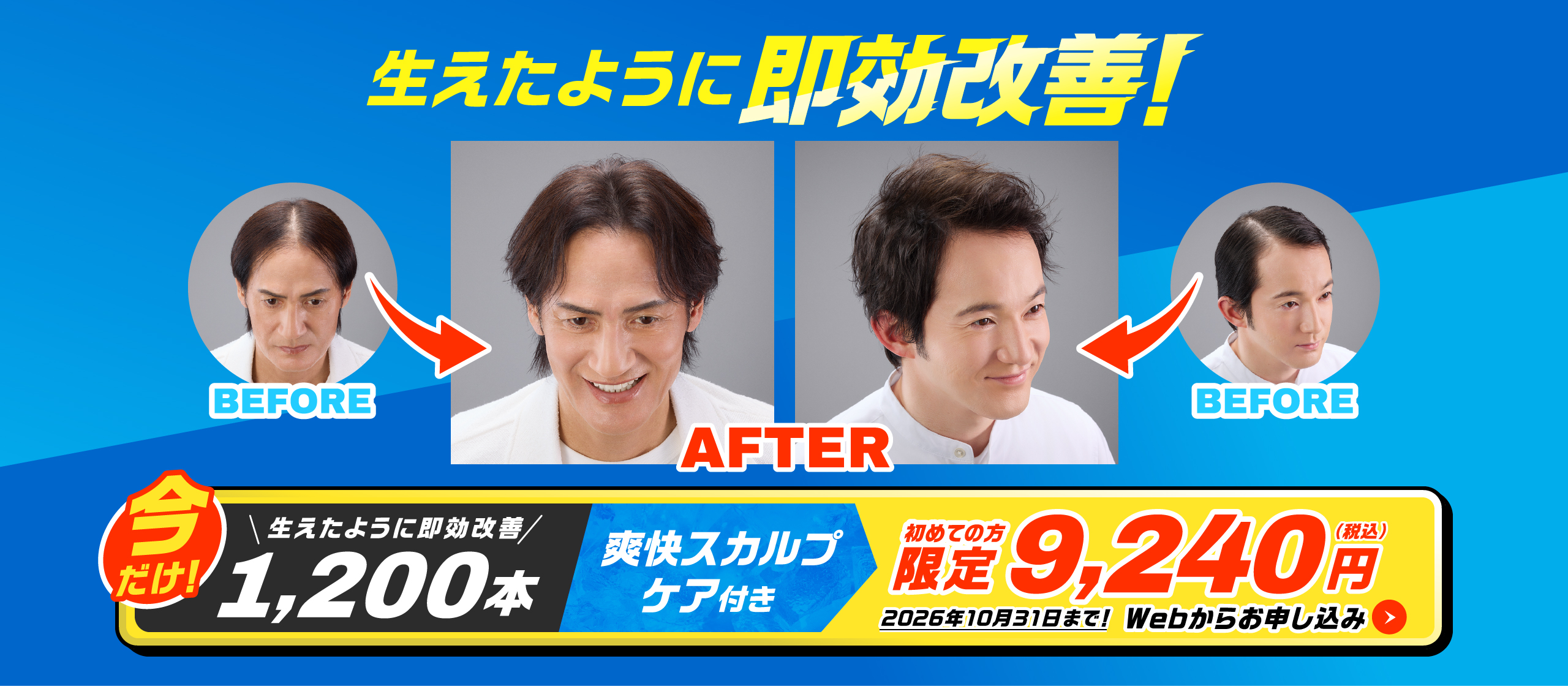 生えたように即効改善！　即効改善1,200本 爽快スカルプケア付き 今だけ9,240円(税込) 2026年10月31日まで！Webからお申し込み