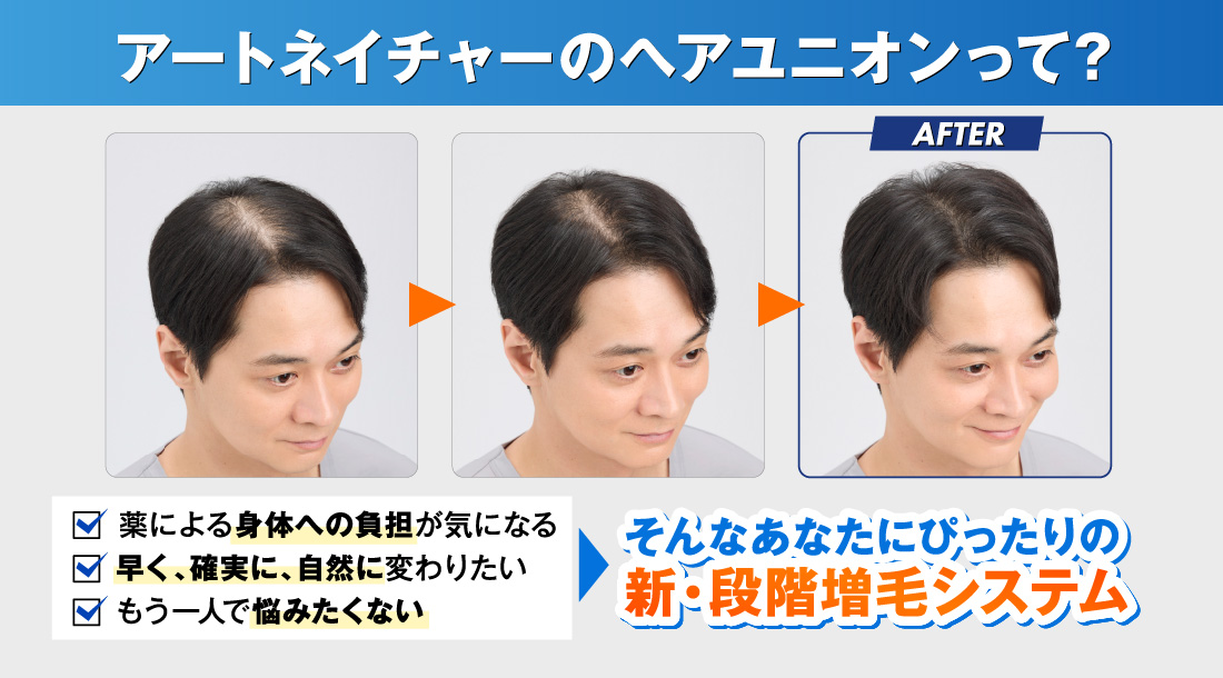 アートネイチャーのヘアユニオンって? 薬による身体への負担が気になる 早く、確実に、自然に変わりたい もう一人で悩みたくない そんなあなたにぴったりの新・段階 増毛システム