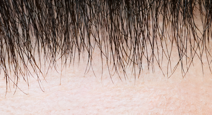 ネイティブフロント加工