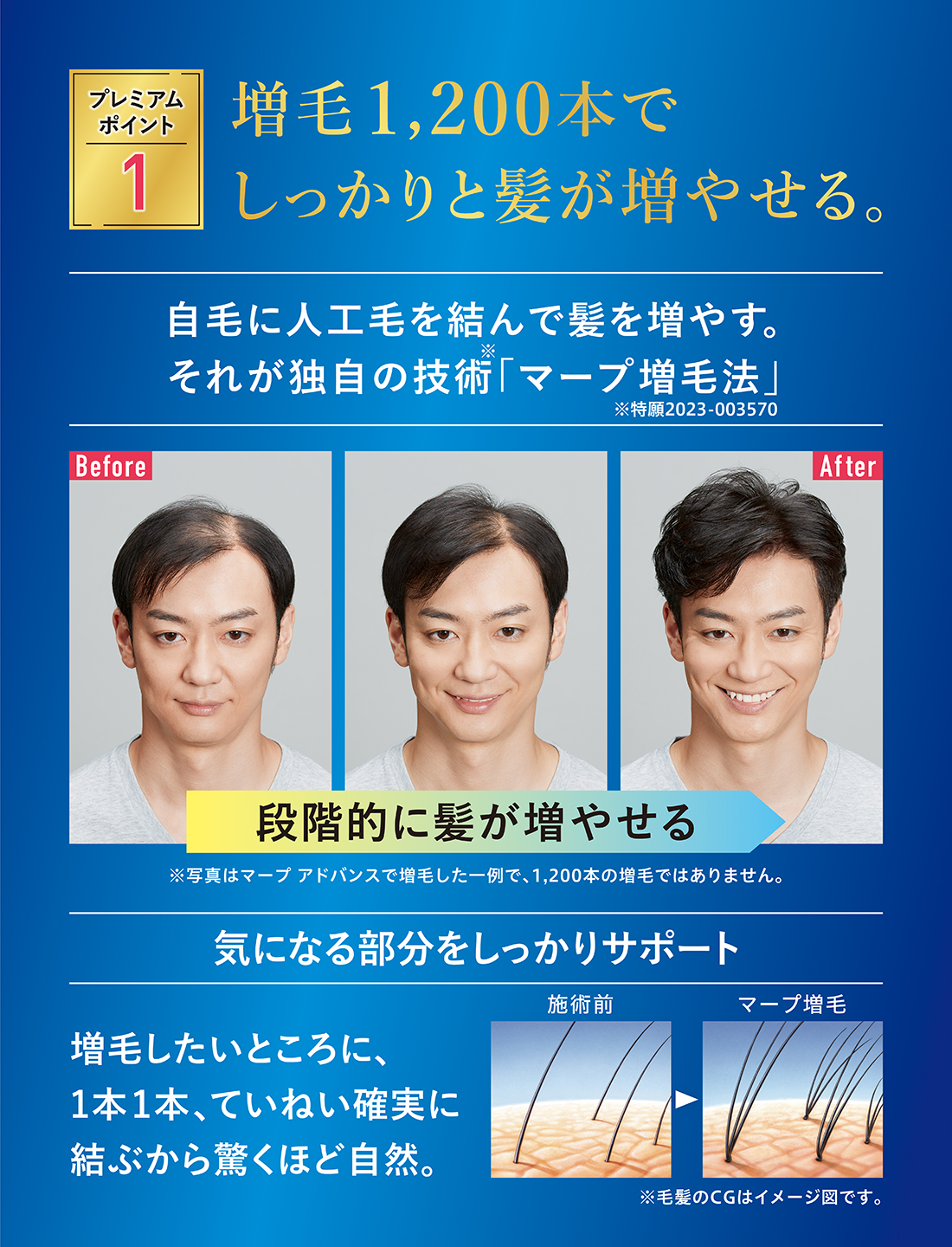 MRP REAL(マープリアル)3つの特長