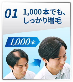 01 1,000本でも、しっかり増毛