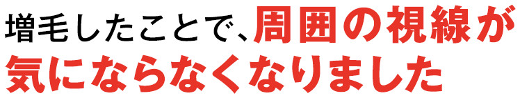 増毛したことで、周囲の視線が気にならなくなりました