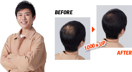 Before → After 1,000本
