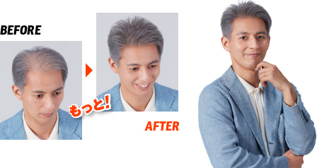 Before → After もっと