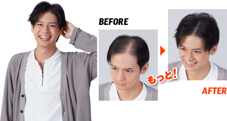 Before → After もっと