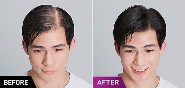 BEFORE AFTER