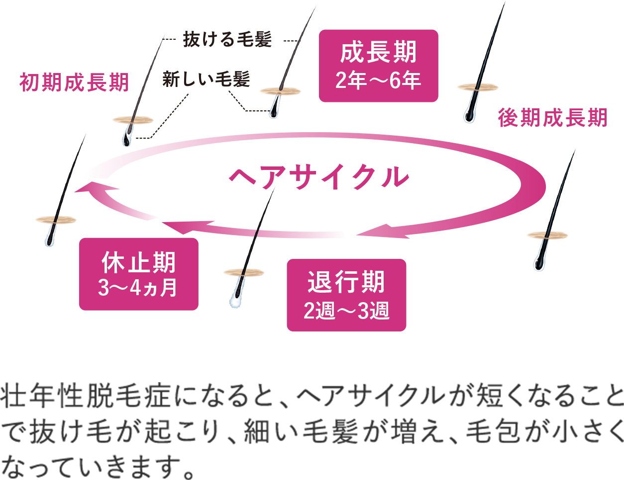 「LABOMO ヘアグロウ ハナミノキ」は、頭皮環境を正常化し、成長期の時間を延ばすことで 抜け毛の進行を防ぎます。